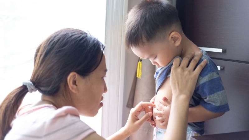 penyebab perut anak buncit