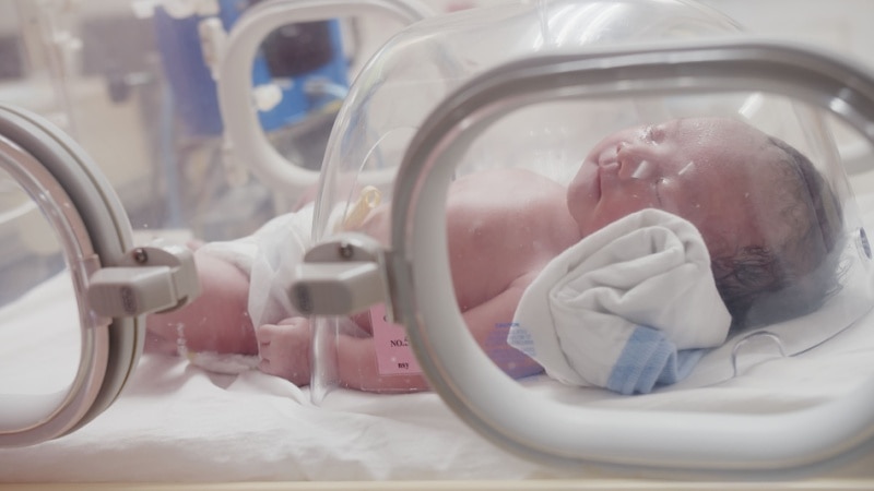perkembangan bayi prematur